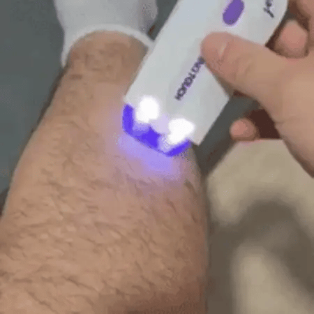 ✨ MÁQUINA DEPILADORA DE VELLO YES – SUAVIDAD SIN DOLOR Y SIN IRRITACIÓN