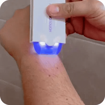 ✨ MÁQUINA DEPILADORA DE VELLO YES – SUAVIDAD SIN DOLOR Y SIN IRRITACIÓN